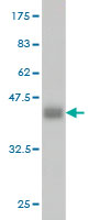 Western blot against tagged recombinant protein immunogen using ab54990 ADH4 antibody at 1ug/ml.