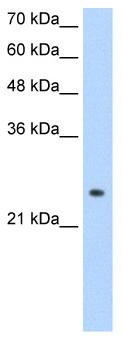 Anti-ADH6 antibody (ab56211) at 1.25 µg/ml + HepG2 cell lysate at 10 µgSecondaryHRP conjugated anti-Rabbit IgG at 1/50000 dilution