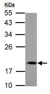 Anti-ADI1 antibody (ab154689) at 1/1000 dilution + Mouse lung lysate at 50 µg