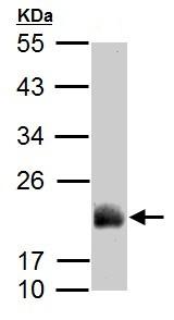 Anti-ADI1 antibody (ab154689) at 1/1000 dilution + Rat lung lysate at 50 µg