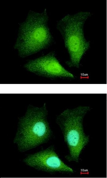 Immunofluorescence analysis of paraformaldehyde-fixed HeLa cells labeling ADI1 with ab154689 at 1/200 dilution. Lower image shows cells co-stained with Hoechst 33342.