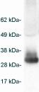 Western blot detection of Adiponectin on mouse serum using ab3455.