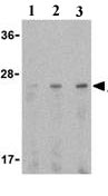 Lane 1 :  Anti-Adiponectin antibody (ab25891) at 0.5 µg/mlLane 2 :  Anti-Adiponectin antibody (ab25891) at 1 µg/mlLane 3 :  Anti-Adiponectin antibody (ab25891) at 2 µg/mlLane 1 : HL60 cell lysateLane 2 : HL60 cell lysateLane 3 : HL60 cell lysate
