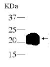 Anti-Adiponectin antibody (ab32003) at 1/3000 dilution (in 1% milk in PBS T at room temperature for 1 hour) + Adiponectin fusion protein (400ng)Secondarygoat anti IgY/Fc HRP at 1/10000 dilutiondeveloped using the ECL technique