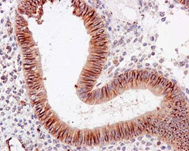 Immunohistochemical staining of paraffin embedded human endometrium with purified ab126611 at a dilution of 1/200. The seconday was a HRP polymer for rabbit IgG amd the counter stain used was hematoxylin.