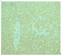 Paraffin section of human liver tissue stained with antibody to human ADPR2 receptor C-terminus ab77613 at 1/250 dilution. 