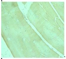 Paraffin section of human muscle tissue stained with antibody to human ADPR2 receptor C-terminus ab77613 at 1/250 dilution.