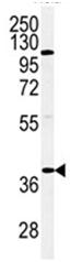Anti-Adiponectin Receptor 2 antibody (ab103678) at 1/100 dilution + Hela cell line lysates at 35 µg