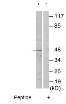 All lanes : Anti-ADPGK antibody (ab70130) at 1/500 dilutionLane 1 : extracts from Jurkat cellsLane 2 : extracts from Jurkat cells with immunising peptide at 10 µgLysates/proteins at 30 µg per lane.