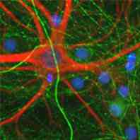 Ab39371 staining Neurofilament in neonatal rat cortical neurons cultured for 14-21 days.