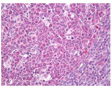 Immunohistochemical analysis of Formulin-Fixed, Paraffin-Embedded (FFPE) Human Tonsil, Germinal Center, labelling ADRM1 with ab134792 at 10 µg/ml.Immunohistochemical analysis of formalin fixed, paraffin embedded Human Tonsil, germinal center, labelling ADRM1 with ab134792 at 10 µg/ml.