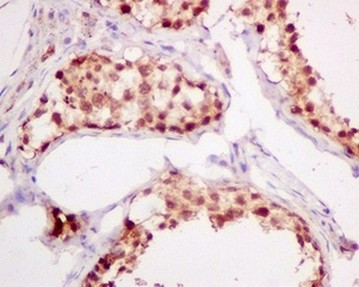 Immunohistochemical analysis of paraffin embedded Human testis tissue labeling ADRM1 with ab157218 at 1/50.