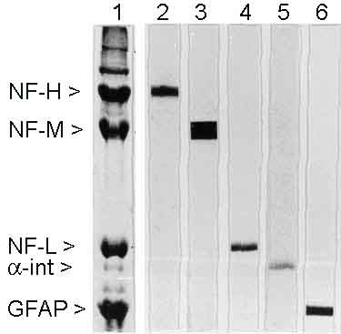 Lane 1 :  Coomassie Blue stainLane 2 :  Heavy neurofilament antibodyLane 3 :  Anti-160 kD Neurofilament Medium antibody [3H11] (ab7256)Lane 4 :  Anti-68kDa Neurofilament antibody [DA2] (ab7255)Lane 5 :  alpha Internexin antibodyLane 6 :  GFAP antibodyLane 1 : Cytoskeletal homogenates of rat spinal cordLane 2 : Cytoskeletal homogenates of rat spinal cordLane 3 : Cytoskeletal homogenates of rat spinal cordLane 4 : Cytoskeletal homogenates of rat spinal cordLane 5 : Cytoskeletal homogenates of rat spinal cordLane 6 : Cytoskeletal homogenates of rat spinal cord