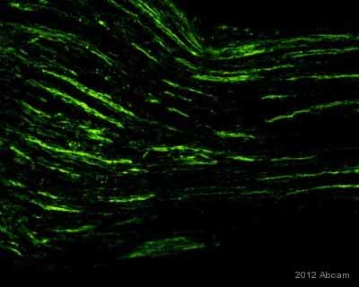 ab72210 staining Advillin in murine sciatic nerve tissue by Immunohistochemistry (Frozen sections).Tissue was fixed in formaldehyde, blocked with 3% BSA for 45 minutes and then incubated with ab72210 at a 1/500 dilution for 16 hours at 4°C. The secondary used was an Alexa-Fluor 488 conjugated goat anti-rabbit polyclonal used at a 1/500 dilution.See Abreview
