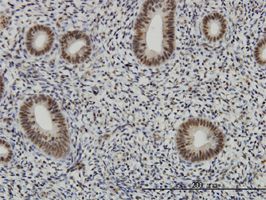 AFF4 antibody (ab57077) used in immunohistochemistry at 1ug/ml on formalin fixed and paraffin embedded human endometrium.