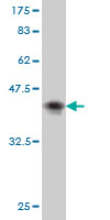 Western blot against tagged recombinant protein immunogen using ab57077 AFF4 antibody at 1ug/ml. 