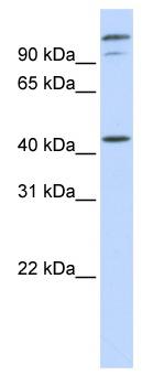 Anti-AFG3L2 antibody (ab83418) at 1 µg/ml (in 5% skim milk / PBS buffer) + HeLa cell lysate at 10 µgSecondaryHRP conjugated anti-Rabbit IgG at 1/50000 dilution