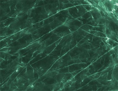 ab7794 at a dilution of 1/1000, staining 160 kD Neurofilament Medium (Alexa 488 secondary at 1/2000) on rat brain tissue (30µm thick coronal sections) in free floating IHC (see protocol link for detailed description). Image taken with a 40x objective. No labeling observed following omission of primary antibody.Sections were viewed using an Axioplan 2 Imaging microscope (Imaging Associates) fitted with 10x, 20x and 40x Plan-Neofluorobjectives (Zeiss, Germany) and images were taken using a AxioCam Hrm digital camera (Zeiss, Germany) and AxioVision software (Imaging Associates).