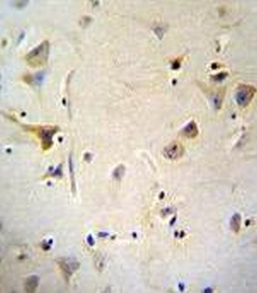 Immunohistochemical analysis in formalin fixed, paraffin embedded Human brain tissue labeling AGBL5 with ab170541 at 1/50, followed by peroxidase conjugation of the secondary antibody and DAB staining.