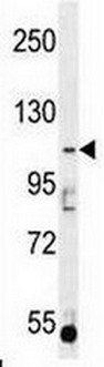 Anti-AGBL5 antibody - N-terminal (ab170541) at 1/100 dilution + K562 cell lysate at 35 µgSecondaryAnti-rabbit HRP conjugated antibody at 1/10000 dilutiondeveloped using the ECL technique