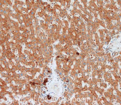 IHC image of Aggrecan staining in human liver formalin fixed paraffin embedded tissue section, performed on a Leica BondTM system using the standard protocol F. The section was pre-treated using heat mediated antigen retrieval with sodium citrate buffer (pH6, epitope retrieval solution 1) for 20 mins. The section was then incubated with ab36861, 5µg/ml, for 15 mins at room temperature and detected using an HRP conjugated compact polymer system. DAB was used as the chromogen. The section was then counterstained with haematoxylin and mounted with DPX. For other IHC staining systems (automated and non-automated) customers should optimize variable parameters such as antigen retrieval conditions, primary antibody concentration and antibody incubation times.