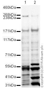All lanes : Anti-Aggrecan antibody (ab36861) at 1 µg/mlLane 1 : Liver (Mouse) Tissue LysateLane 2 : Liver (Rat) Tissue LysateLysates/proteins at 10 µg per lane.SecondaryGoat Anti-Rabbit IgG H&L (HRP) (ab97051) at 1/10000 dilutiondeveloped using the ECL techniquePerformed under reducing conditions.