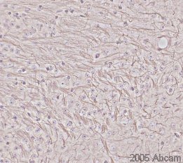 The image illustrates the high definition dendritic staining obtained after protease pretreatment. This picture was kindly supplied as part of the review submitted by Prof Colm Cunningham and Dr Suzanne Campion (Southampton University). 