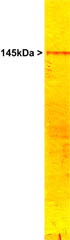 Anti-160 kD Neurofilament Medium antibody - Neuronal Marker (ab9034) at 1/20000 dilution + whole rat cerebellum homogenate