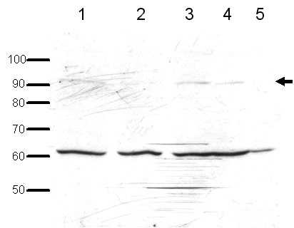 All lanes : Anti-Ago1 antibody (ab18190) at 1 µg/mlLane 1 : S.pombe wild-type whole cell extractLane 2 : S.pombe ago1Δ whole cell extractLane 3 : S.pombe endogenously expressed tagged Ago1 whole cell extractLane 4 : S.pombe over-expressed tagged Ago1 whole cell extractLane 5 : S.pombe repressed tagged Ago1 whole cell extractLysates/proteins at 20 µg per lane.