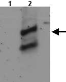 All lanes : Anti-Agpat2 antibody (ab21816) at 1/1000 dilutionLane 1 : Total protein extract from E. coli with ~50ng to 100ng of a negative control fusion protein with an irrelevant antigen at 20 ugLane 2 : Total protein extract from E. coli with ~50ng to 500ng of the antigen fusion protein at 20 ugSecondaryRabbit anti-mouse IgG + IgM, (H+L) horseradish peroxidase conjugated at 1/5000 dilution