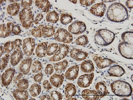 AHCYL1 antibody (ab56761) used in immunohistochemistry at 3ug/ml on formalin fixed and paraffin embedded human stomach.