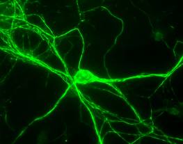 Rat Neurons stained with chicken anti-NF-H (green). The NF-H antibody was used at a dilution of 1/100000 using our standard fixation and staining procedure (in protocol section). 