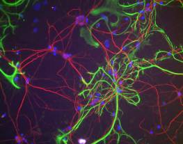 Rat Neurons stained with NFH (red) and rabbit polyclonal to GFAP(green). The NF-H antibody was used at a dilution of 1/100000 and the GFAP at a dilution of 1:2,000 using our standard fixation and staining procedure (see protocol section).