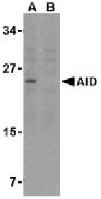 All lanes : Anti-AICDA antibody - ChIP Grade (ab59361) at 2 µg/mlLane 1 : Ramos cell lysate Lane 2 : Ramos cell lysate with immunizing peptideLysates/proteins at 15 µg per lane.