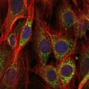 ab119917 at 1/200 dilution staining AIF in NIH 3T3 cells by Immunofluorescence (green). Blue: DRAQ5 fluorescent DNA dye. Red: Actin filaments have been labeled with Alexa Fluor-555 phalloidin.