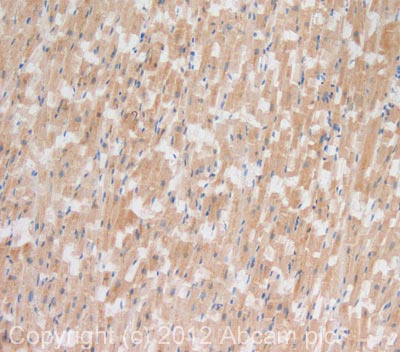 IHC image of AIF staining in human heart formalin fixed paraffin embedded tissue section, performed on a Leica BondTM system using the standard protocol F. The section was pre-treated using heat mediated antigen retrieval with sodium citrate buffer (pH6, epitope retrieval solution 1) for 20 mins. The section was then incubated with ab110327, 10µg/ml, for 15 mins at room temperature and detected using an HRP conjugated compact polymer system. DAB was used as the chromogen. The section was then counterstained with haematoxylin and mounted with DPX. For other IHC staining systems (automated and non-automated) customers should optimize variable parameters such as antigen retrieval conditions, primary antibody concentration and antibody incubation times.