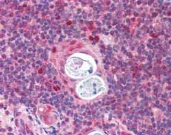 ab13573 at 2.5 µg/ml staining Human Thymus by IHC-P. Thymic medula shows staining of select nuclei. Steamed antigen retrieval with citrate buffer pH6, AP-staining.