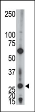 Anti-AK2 antibody (ab71729) at 1/100 dilution + Jurkat cell lysate at 12.5 µg