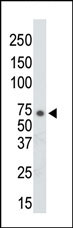 Anti-AK7 antibody - Aminoterminal end (ab38176) at 1/100 dilution + T47D cell lysate