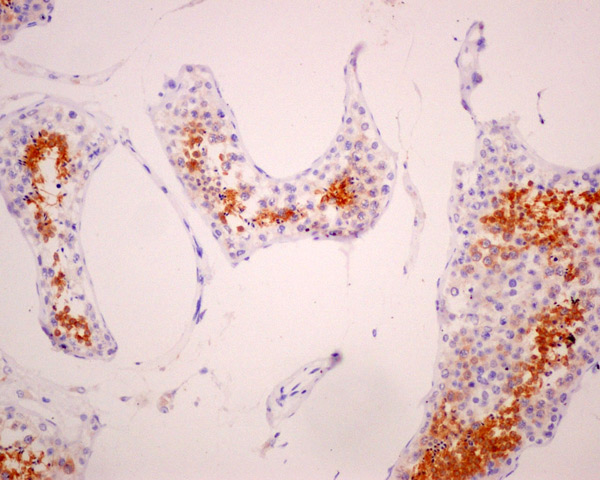 ab173298 showing +ve staining in Human normal testis tissue.