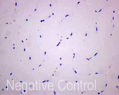 ab173298 showing -ve staining in Human skeletal muscle tissue.