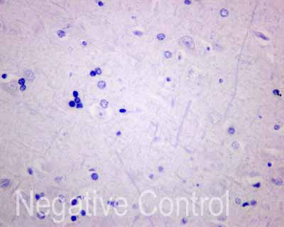 ab173298 showing -ve staining in Human normal brain tissue.