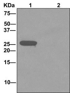Immunoprecipitation. ab173298 at 1/1000 staining AKAP associated Sperm Protein immunoprecipitated from Human tetis lysate using ab173297 at 1/10.Lane 2: 1X PBS (negative control) .