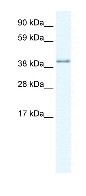 Anti-AKAP7 antibody (ab30987) at 1.25 µg/ml (in 5% skim milk / PBS buffer) + fetal brain lysateSecondaryHRP conjugated anti-Rabbit IgG at 1/50000 dilution