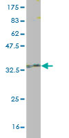 Western blot against tagged recombinant protein immunogen using ab56593 AKAP7 antibody at 1ug/ml.