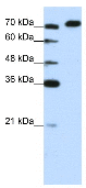 Anti-AKAP8L antibody (ab51342) at 1.25 µg/ml + Jurkat cell lysate at 10 µgSecondaryHRP conjugated anti-Rabbit IgG (1:100,000)