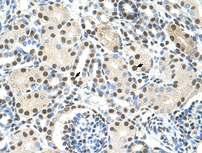 Immunohistochemistry (Formalin/PFA-fixed paraffin-embedded sections) analysis of human kidney tissue labelling AKAP8L with abAKAP8L at 4-8µg/ml. Arrows indicate positively labelled epithelial cells of renal tubule. Magnification: 400X.