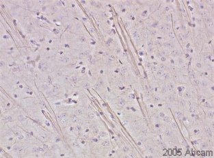The image showing results obtained after protease pretreatment, illustrating high definition neurofilament staining. This picture was kindly supplied as part of the review submitted by Prof Colm Cunningham and Dr Suzanne Campion (Southampton University). 