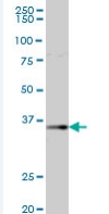Anti-AKR1B1 antibody (ab67063) at 1/500 dilution + Human kidney tissue lysate at 25 µgSecondaryGoat anti-mouse IgG (H&L)-HRP conjugate at 1/2500 dilution
