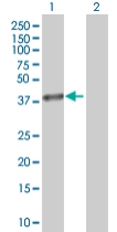 All lanes : Anti-AKR1B1 antibody (ab67063) at 1/500 dilutionLane 1 : AKR1B1 transfected 293T cell lysateLane 2 : Non transfected 293T cell lysateLysates/proteins at 25 µg per lane.SecondaryGoat anti-mouse IgG (H&L)-HRP conjugate at 1/2500 dilution